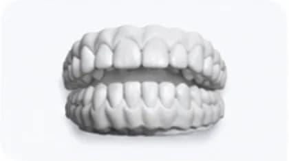 Illustration of a 3D dental scan